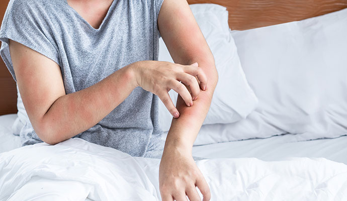 Itchy skin rash on the arm